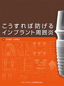 こうすれば防げるインプラント周囲炎（2012年  クインテッセンス出版）