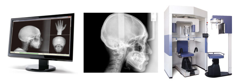 セファロX線撮影装置